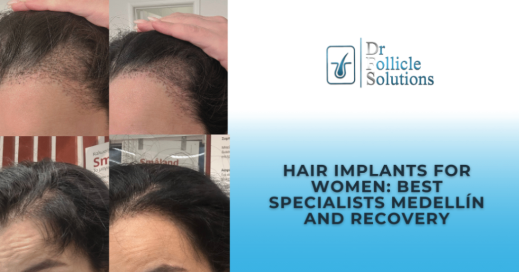 Hair Implants for Women: Best Specialists Medellín