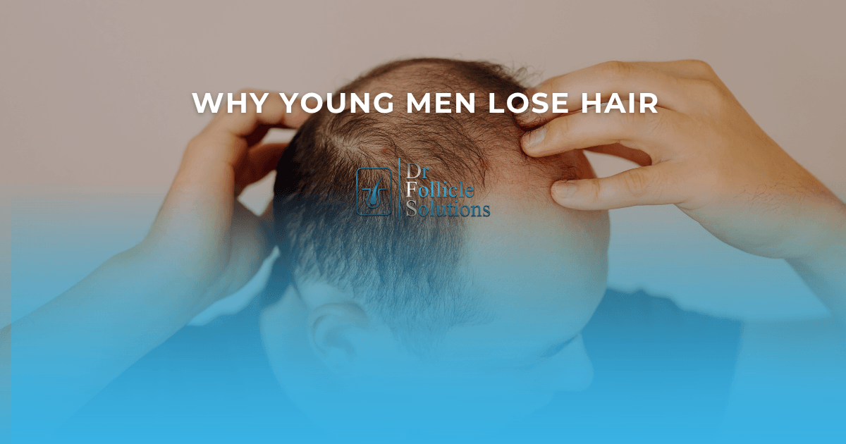 why is hair falling out in young men
