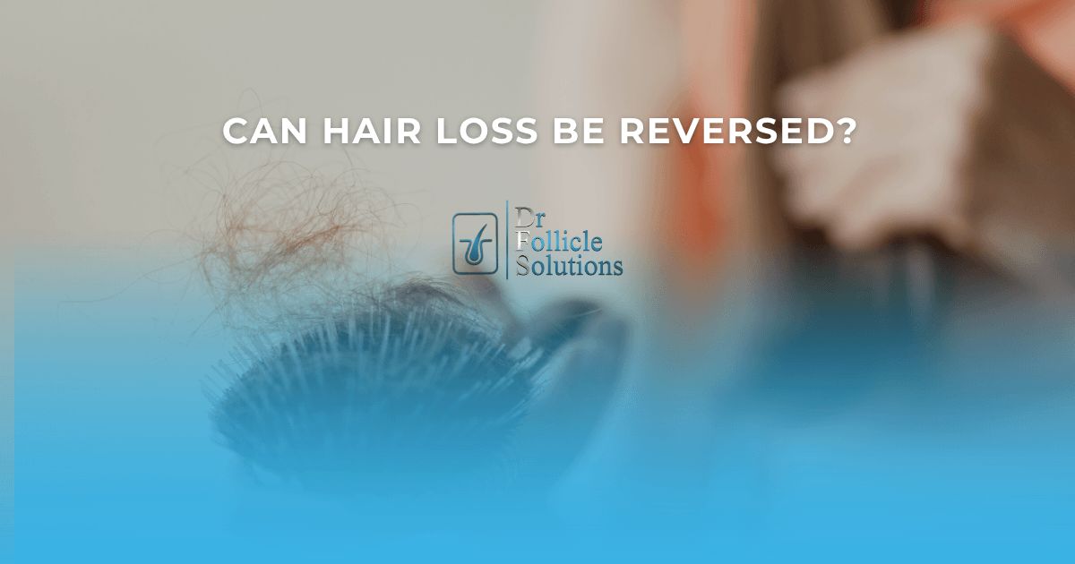 can hair loss be reversed