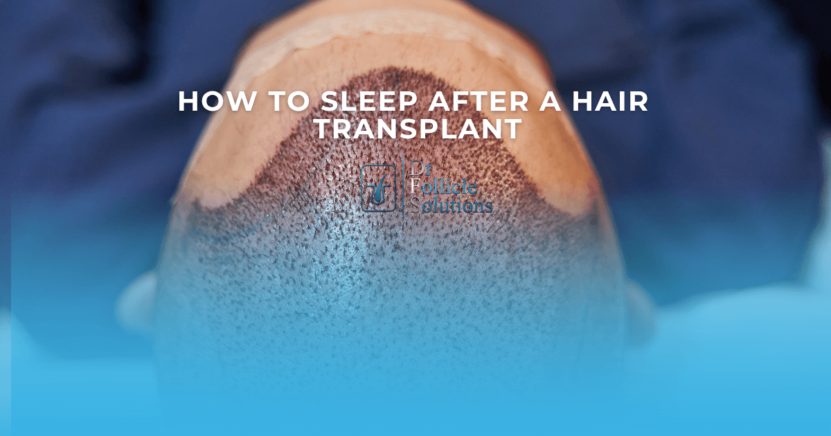 how to sleep after a hair transplant
