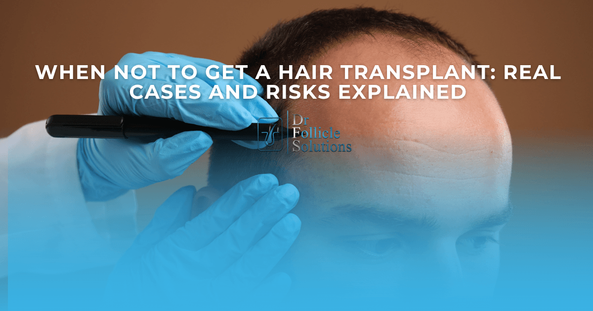 when not to get a hair transplant